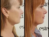Scarlet-S geadviseerd door Dermatologen