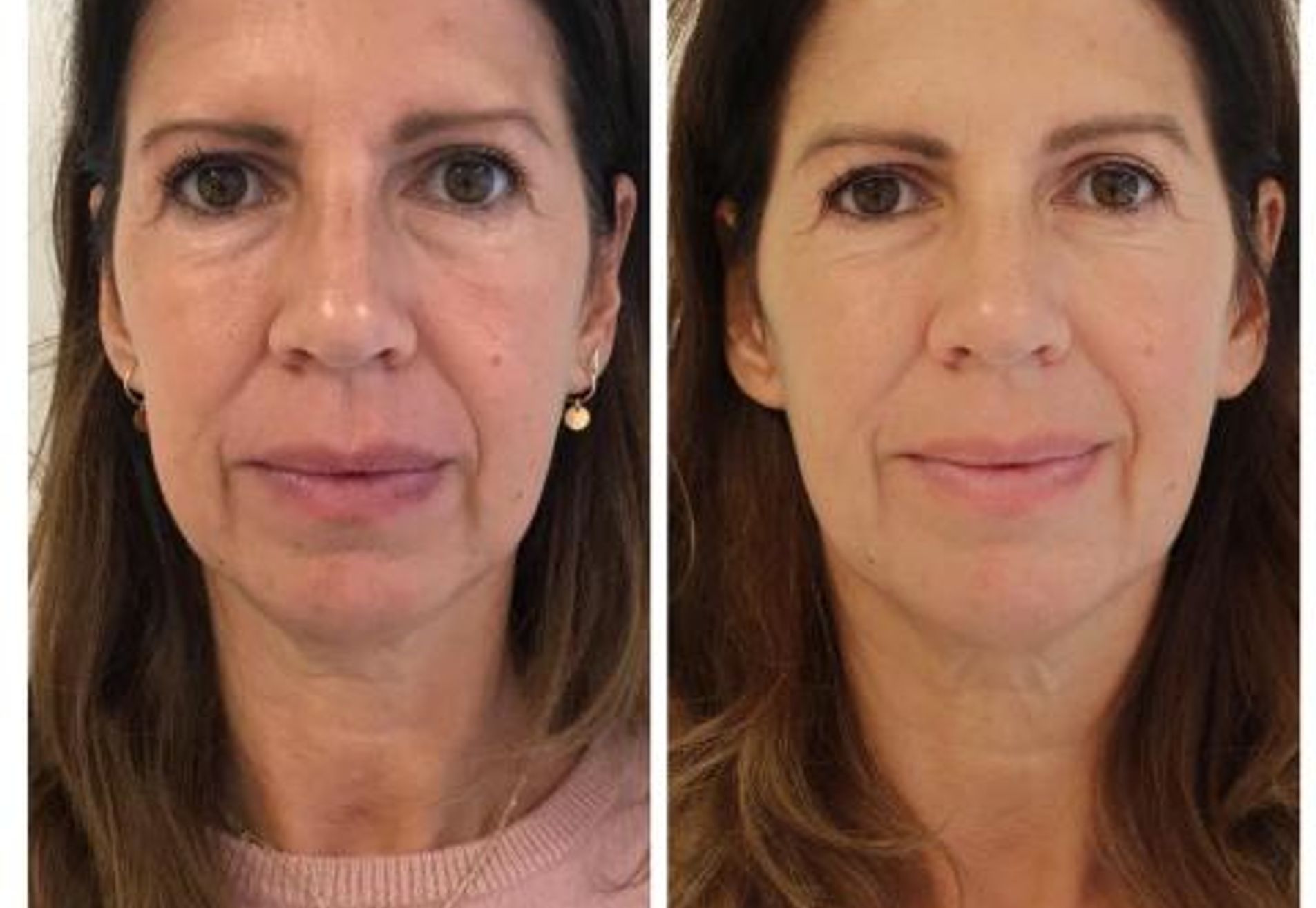 Isa Hoes Jaren Jonger 