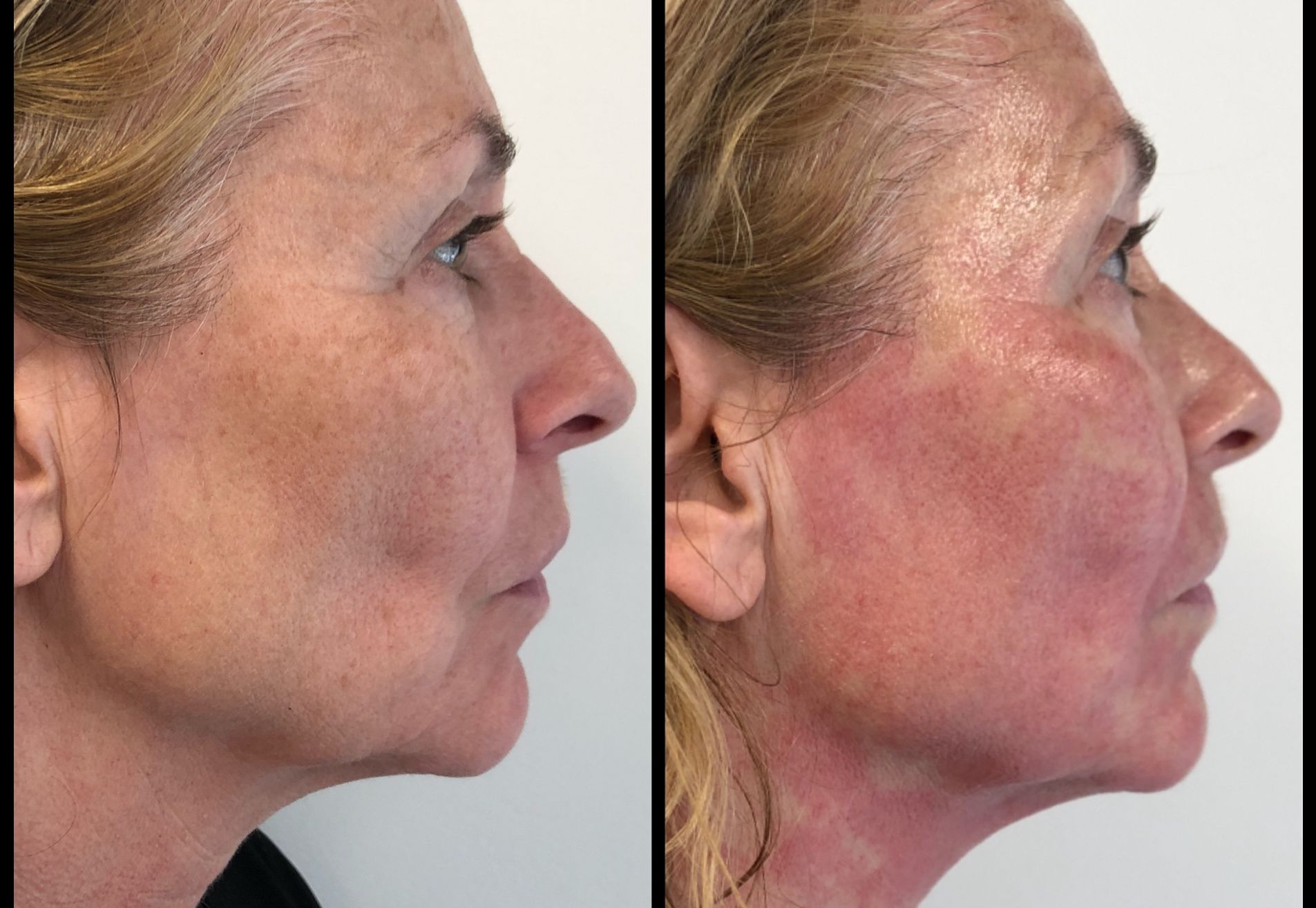 Angela Groothuizen bij Esteworld