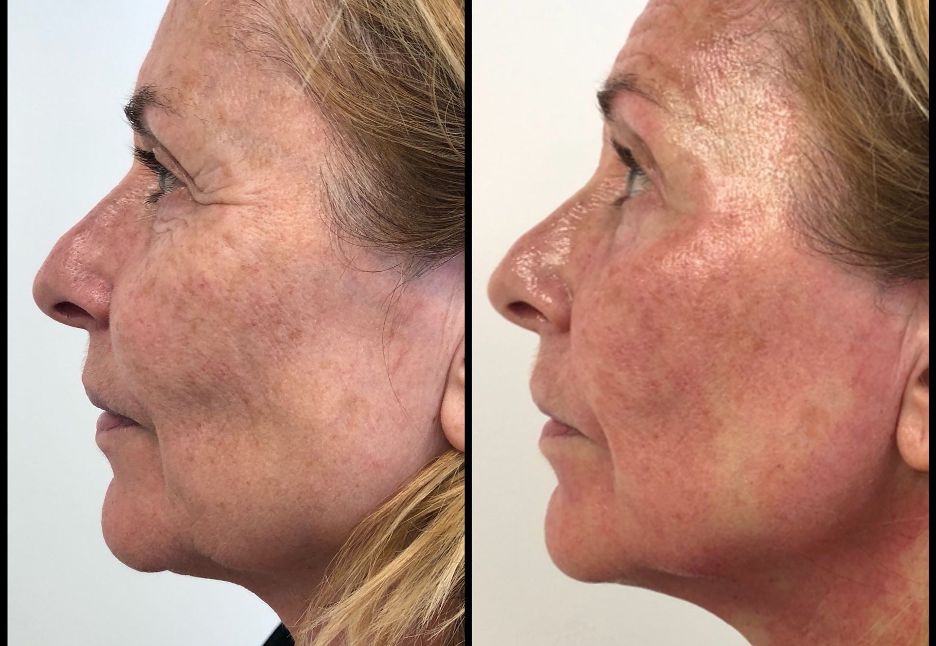 Angela Groothuizen bij Esteworld