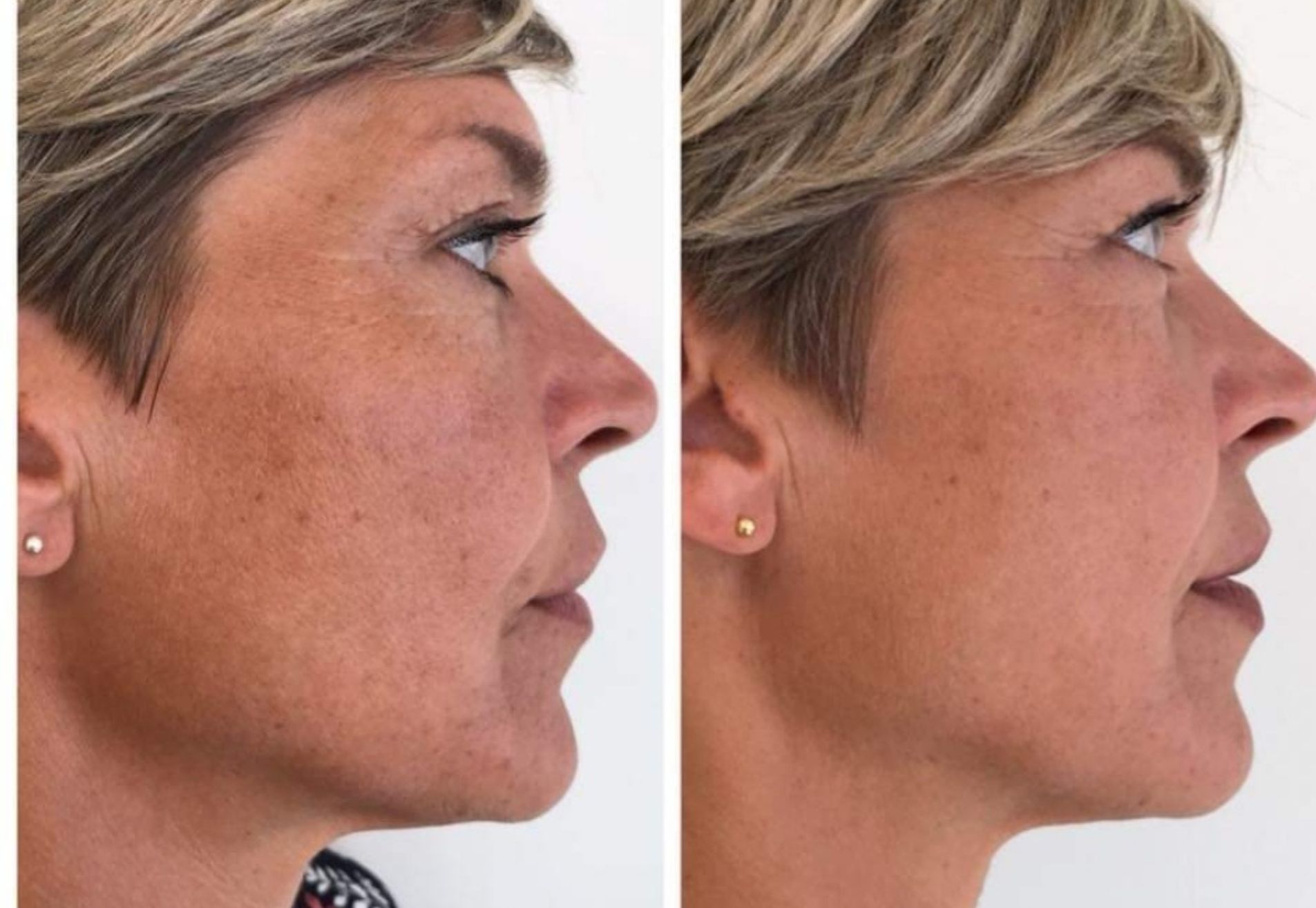 BN'er Medina Schuurman bij Esteworld