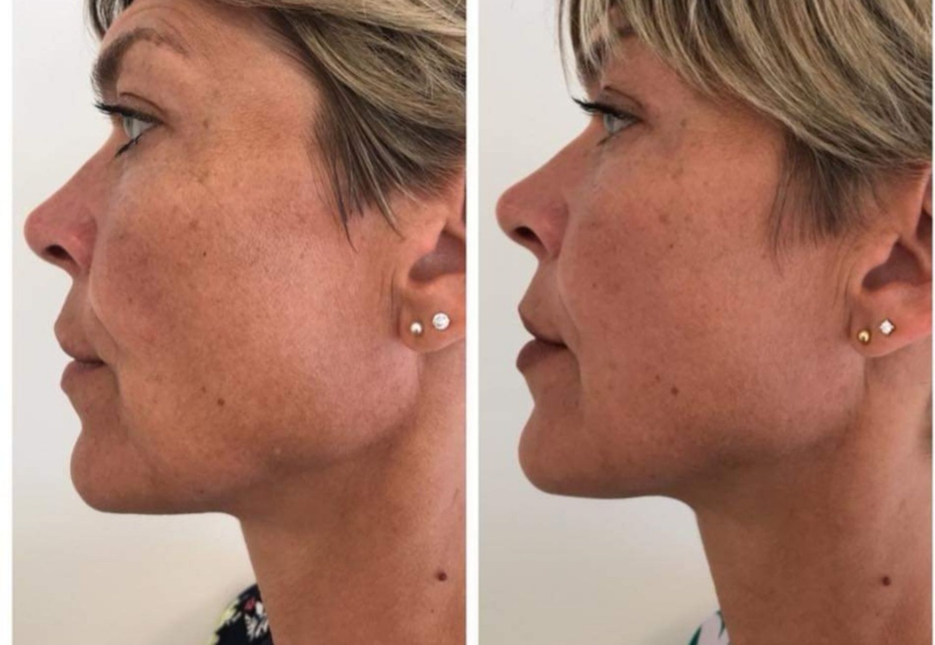 BN'er Medina Schuurman bij Esteworld