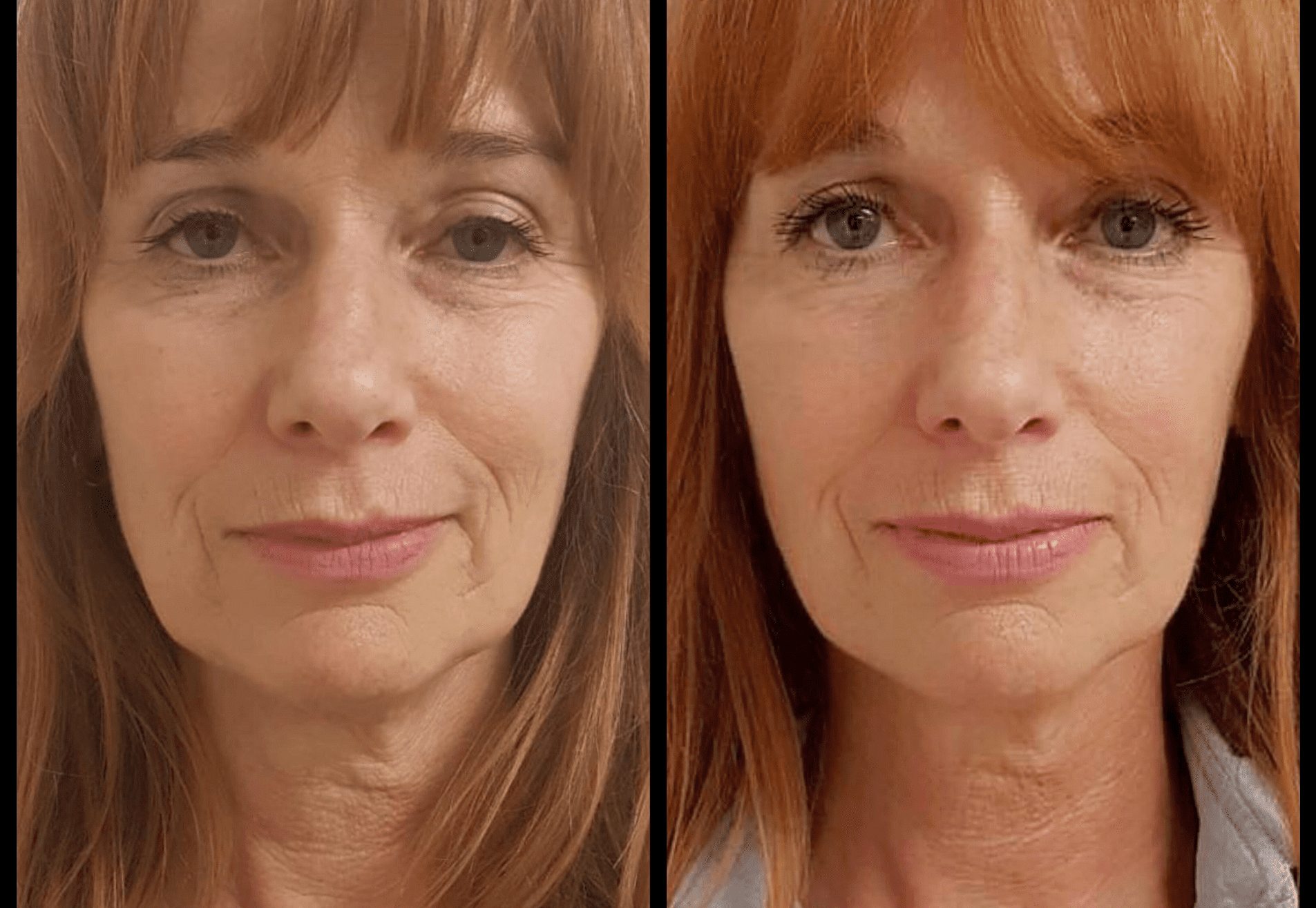 BN'er Patty Zomer (dolly dots) bij Esteworld