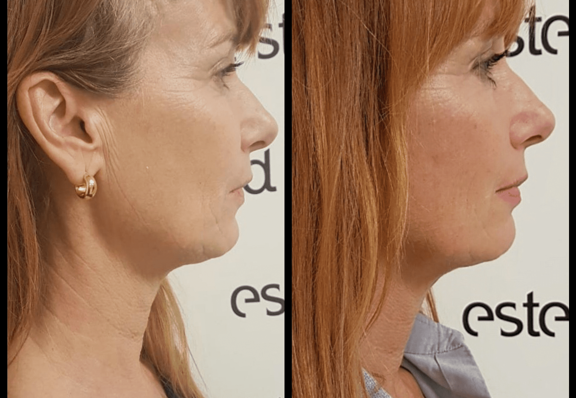 BN'er Patty Zomer (dolly dots) bij Esteworld