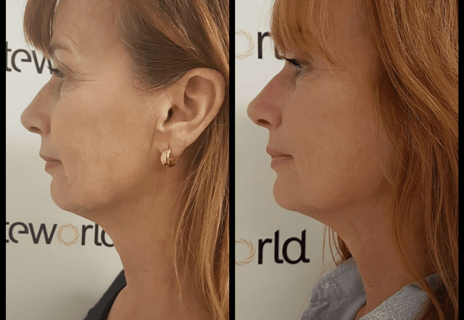 BN'er Patty Zomer (dolly dots) bij Esteworld