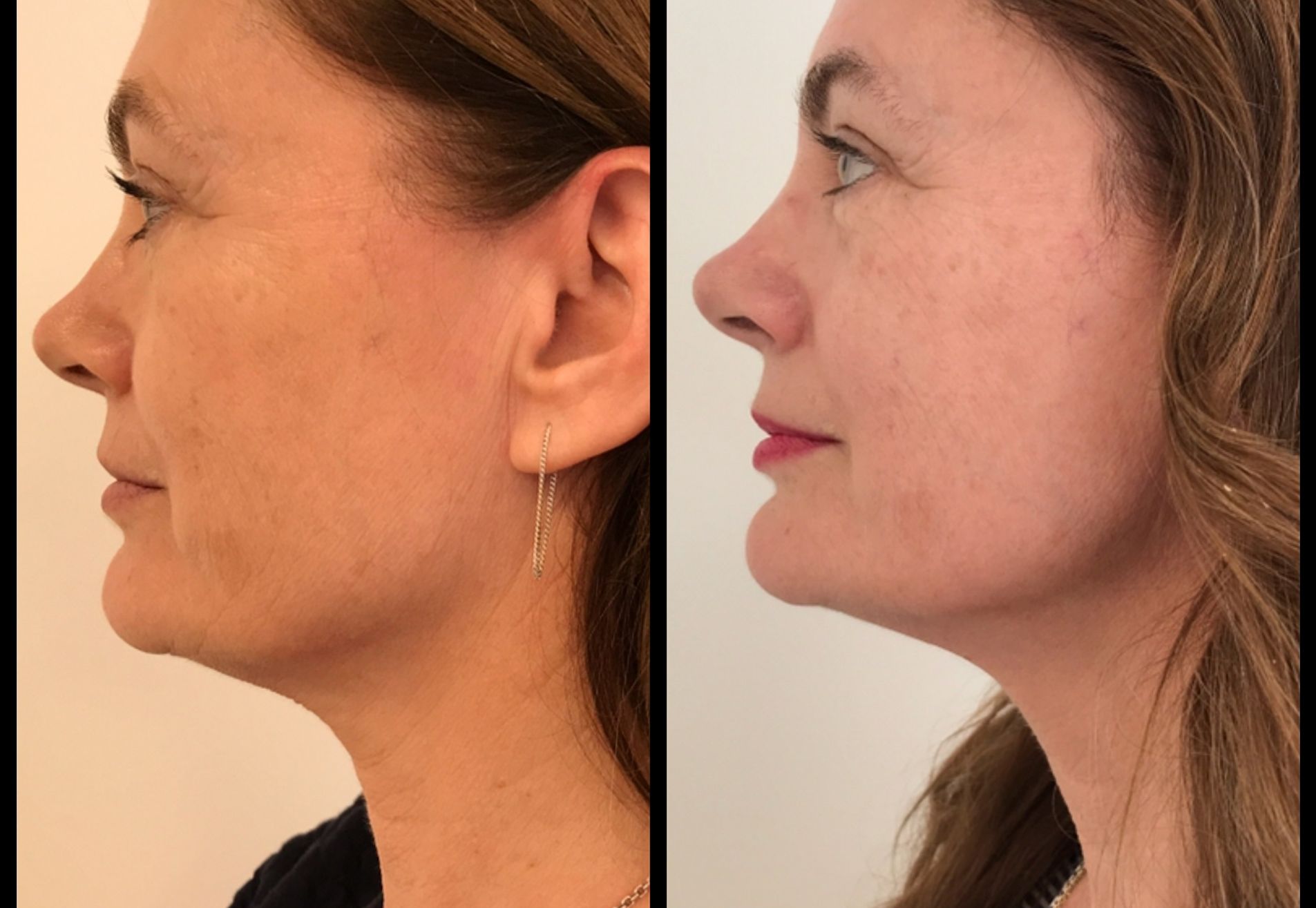 BN'er Lydia le Loux bij Estewold