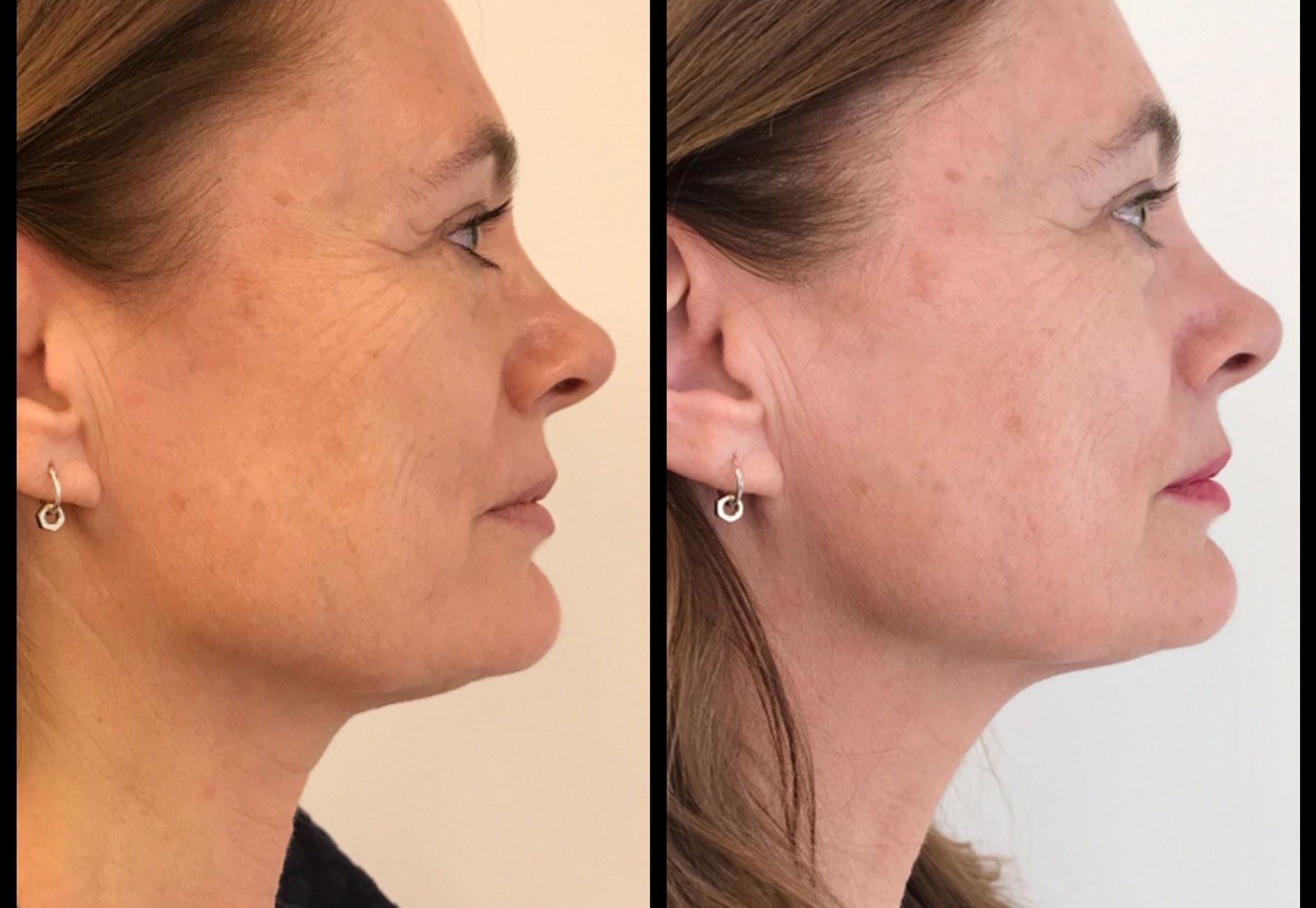 BN'er Lydia le Loux bij Estewold