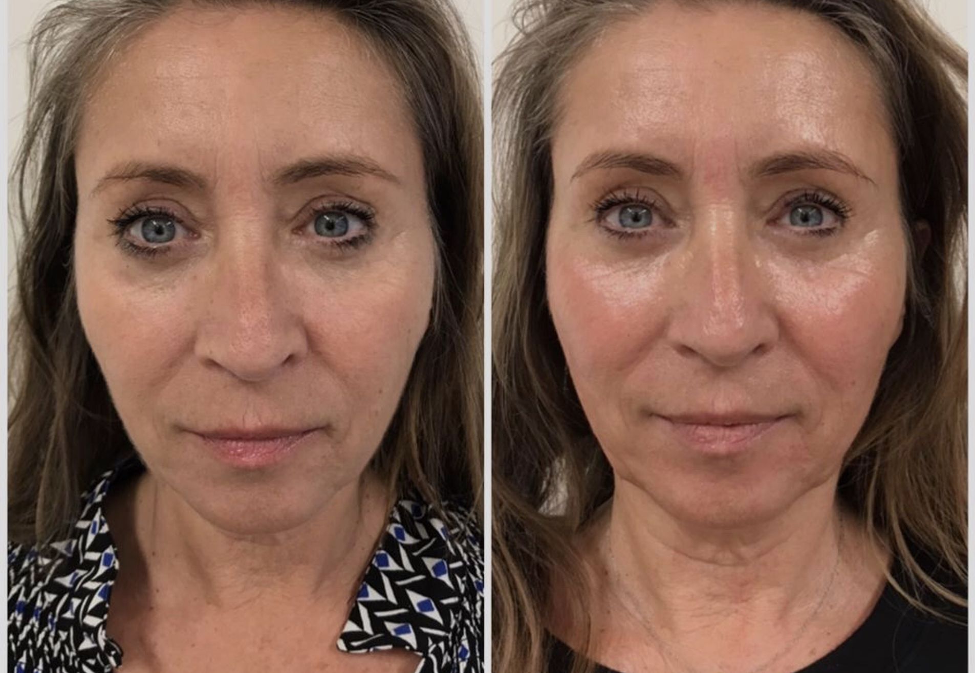 BN'er Mylene Kroon Alles gaat zakken als we er niets tegen doen