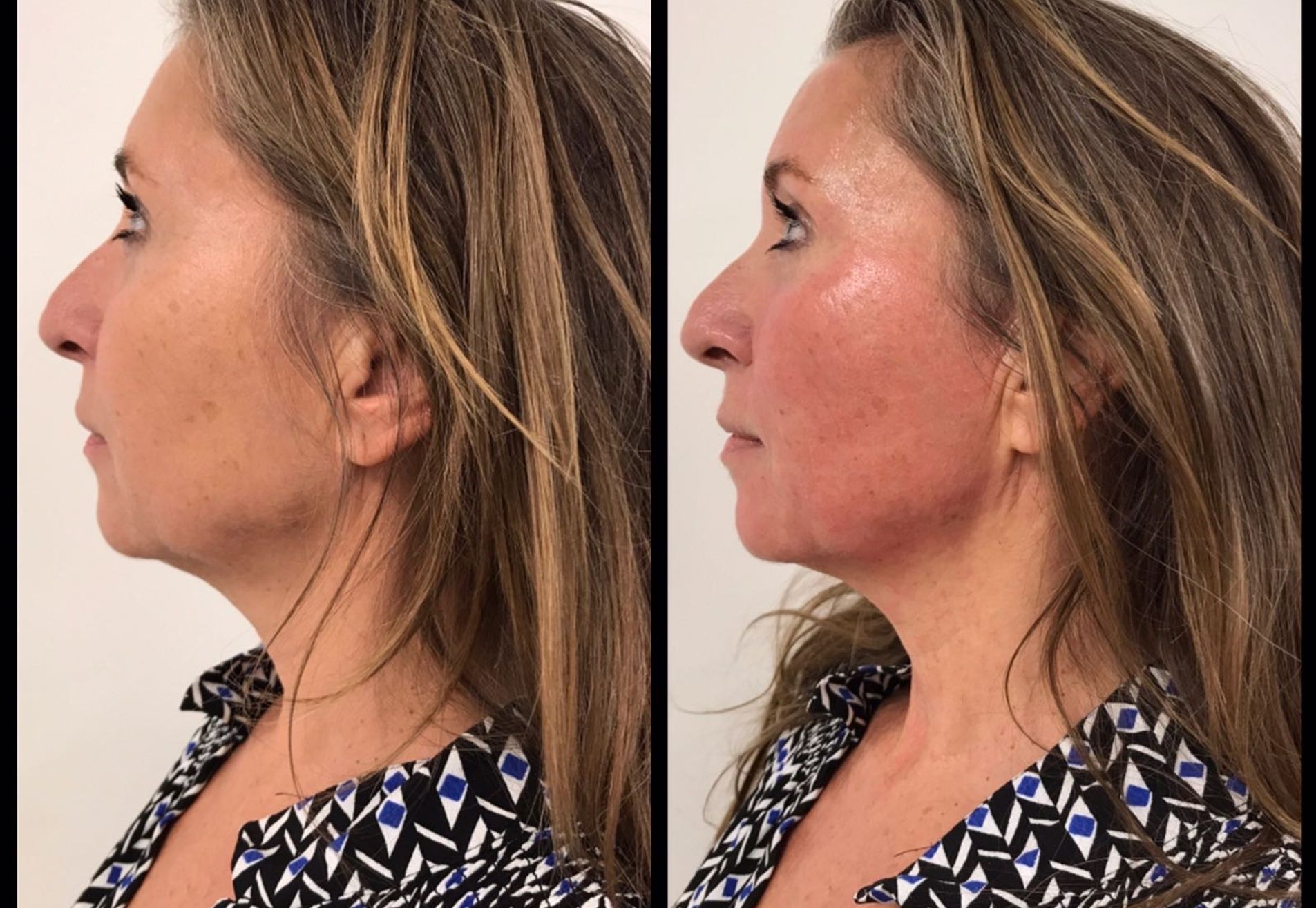 BN'er Mylene Kroon Alles gaat zakken als we er niets tegen doen