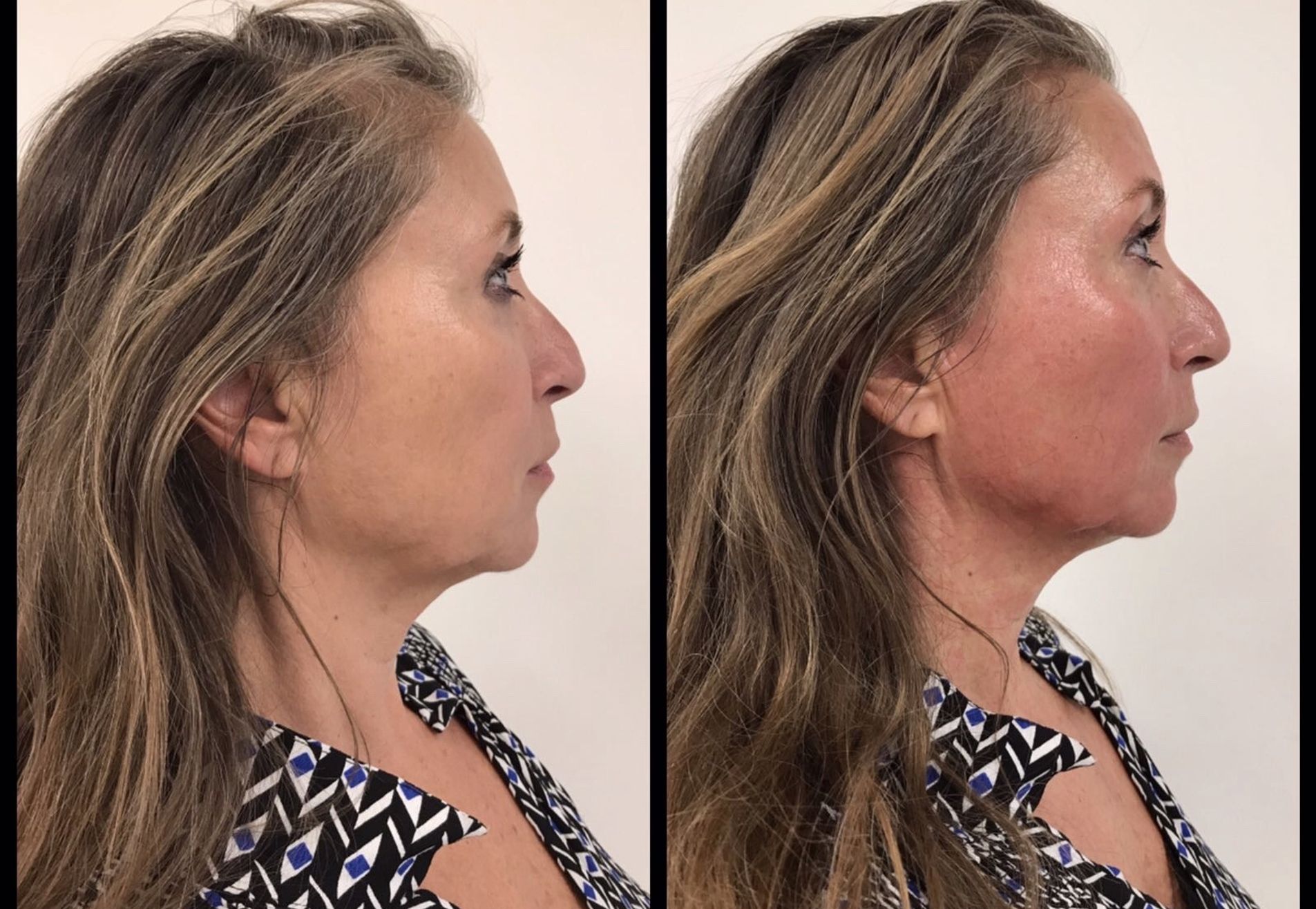 BN'er Mylene Kroon Alles gaat zakken als we er niets tegen doen