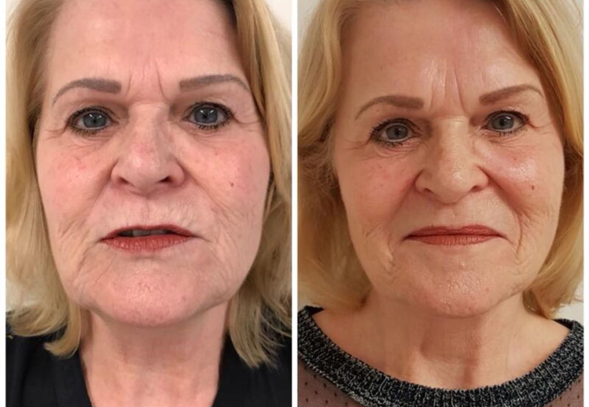 Corrie tweede jeugd