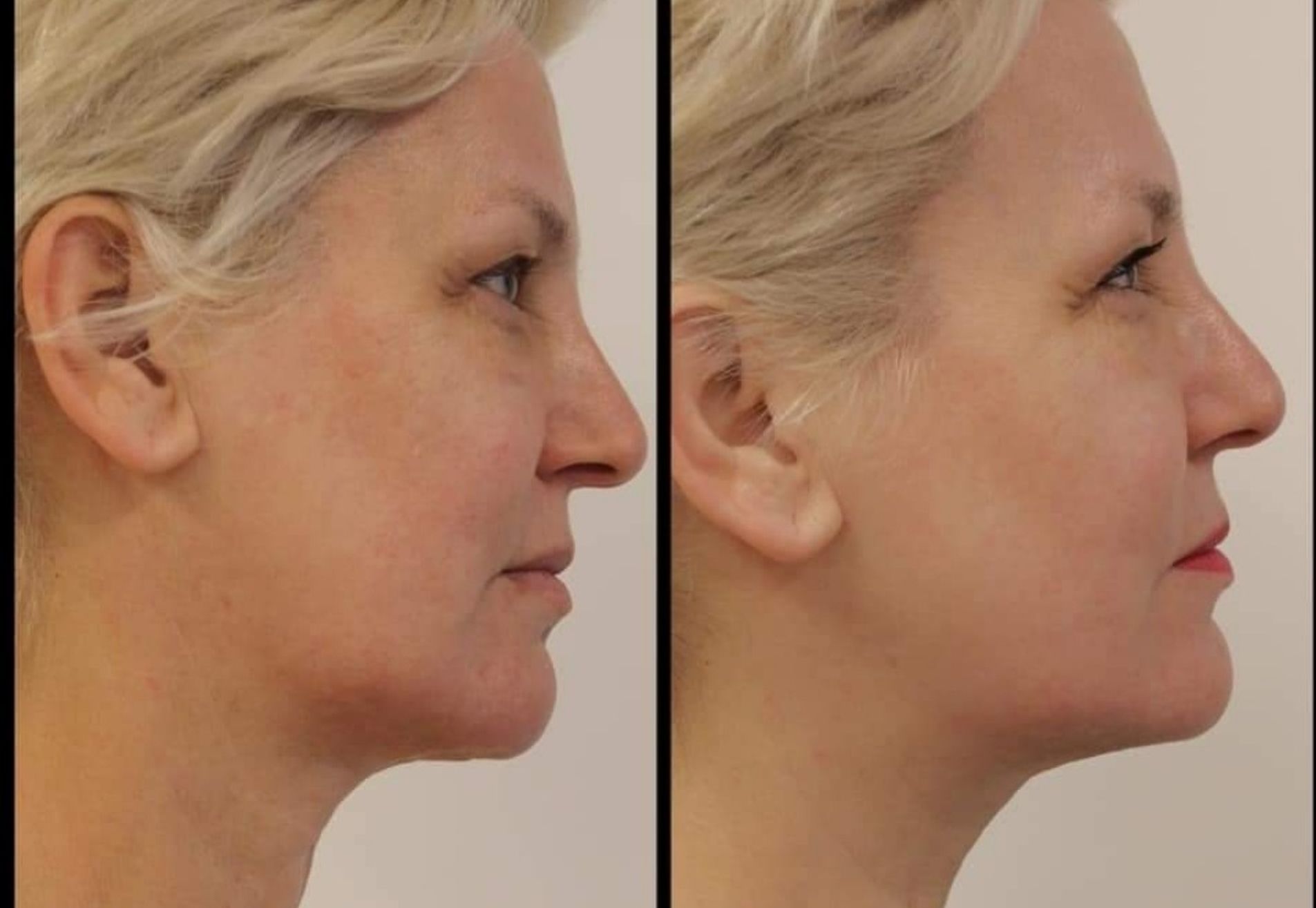 BN'er Marianne Verkerk beauty is mijn vakgebied