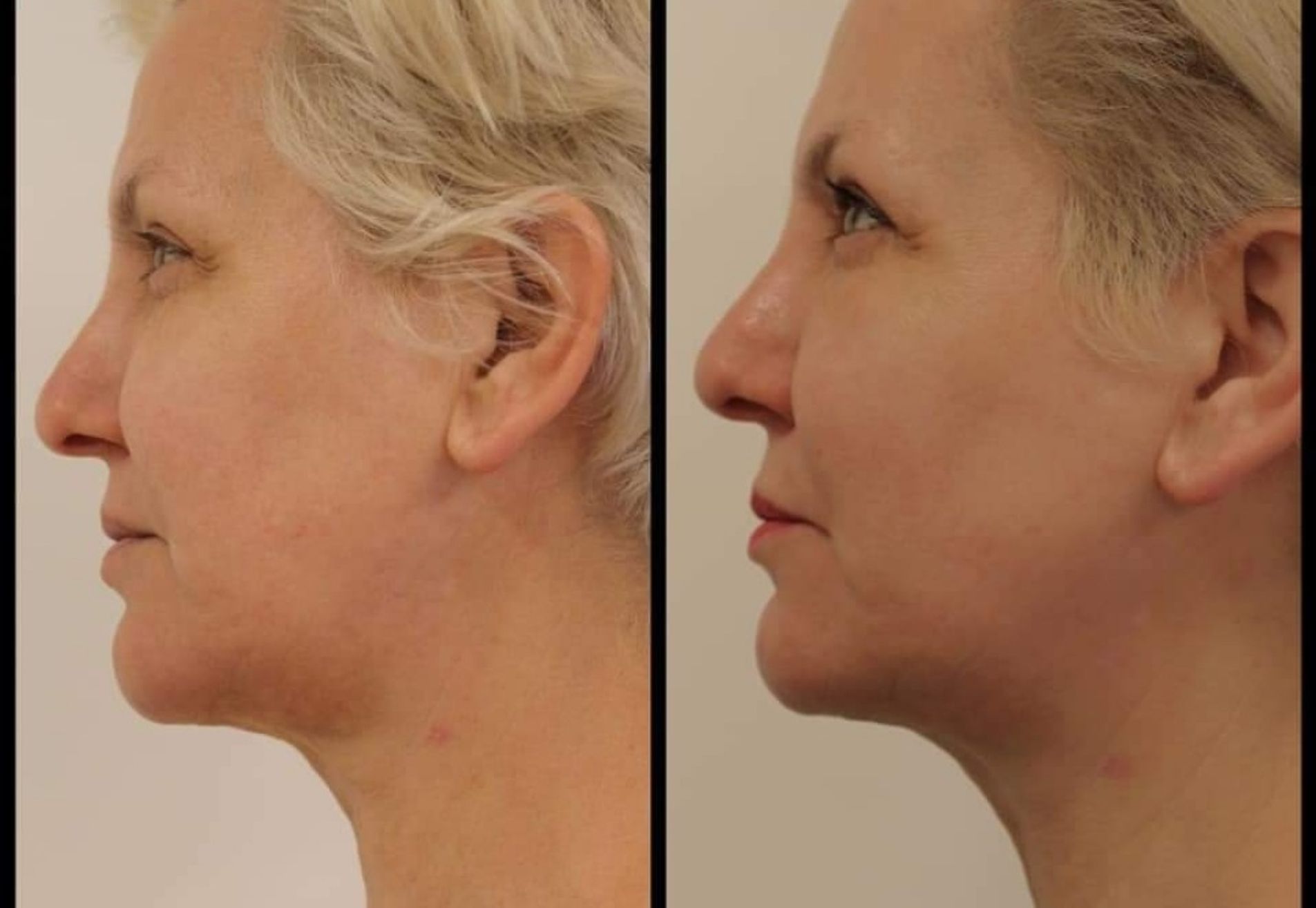 BN'er Marianne Verkerk beauty is mijn vakgebied