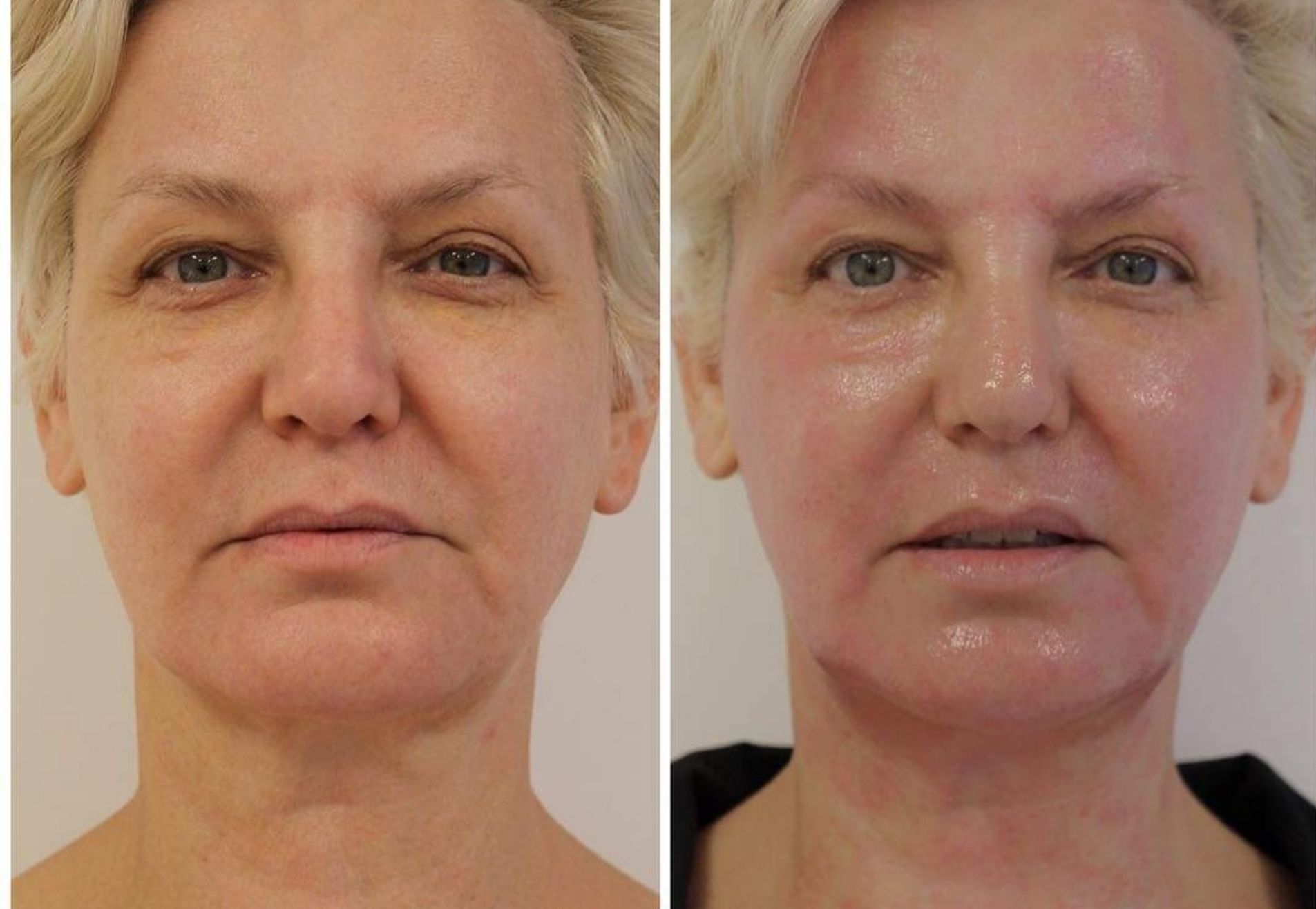 BN'er Marianne Verkerk beauty is mijn vakgebied