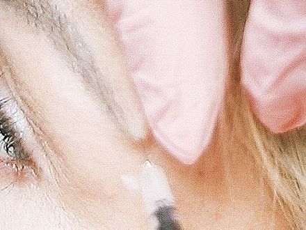 Botox, fillers en adviserende rol door Robert Schoemacher