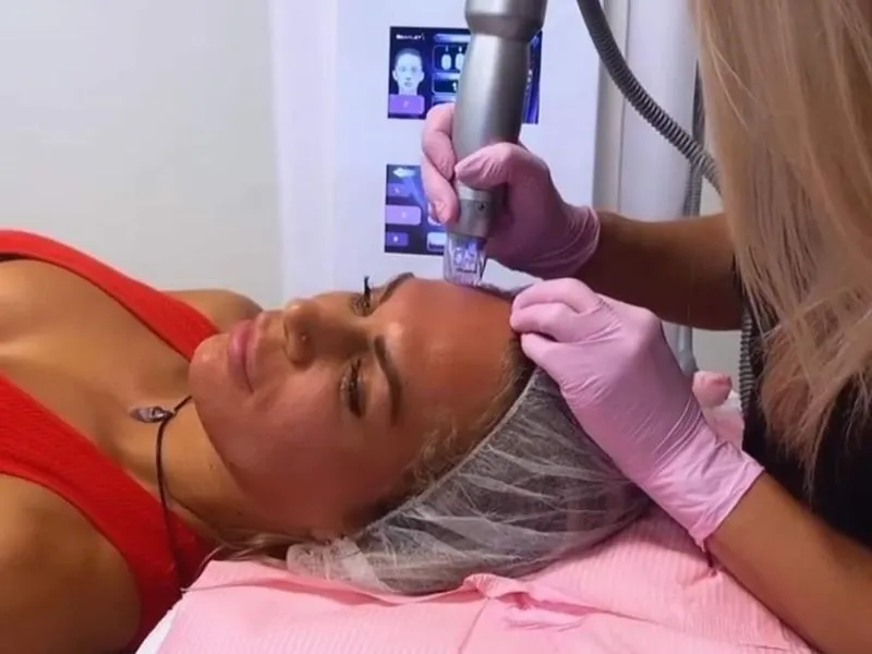 Scarlet-S RF hoe ziet een behandeling er uit?